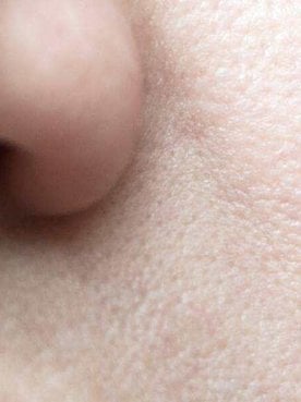 How To Know Your Skin Type