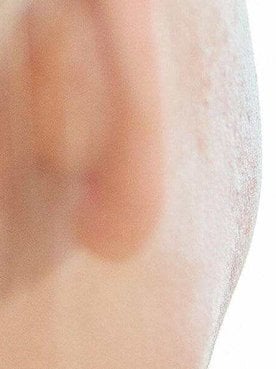 How To Prepare Skin For Foundation
