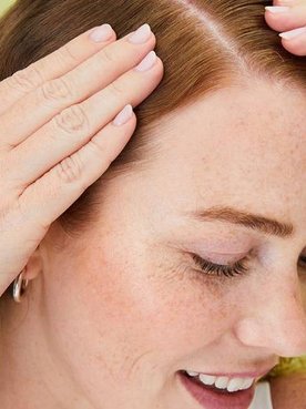 Scalp