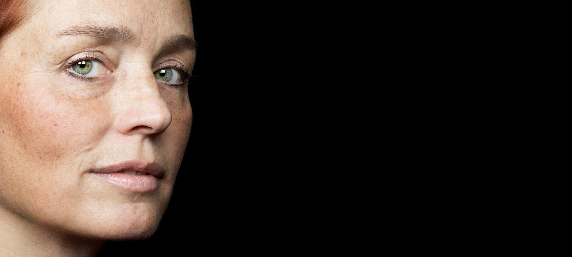 Protect Your Pout With These 5 Homemade Treatments Hero