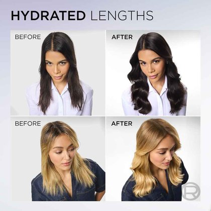 Hyaluron Pure Bundle Before After Girl
