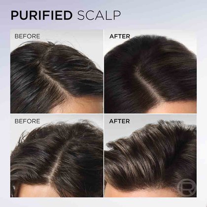 Hyaluron Pure Shampoo Before After Scalp