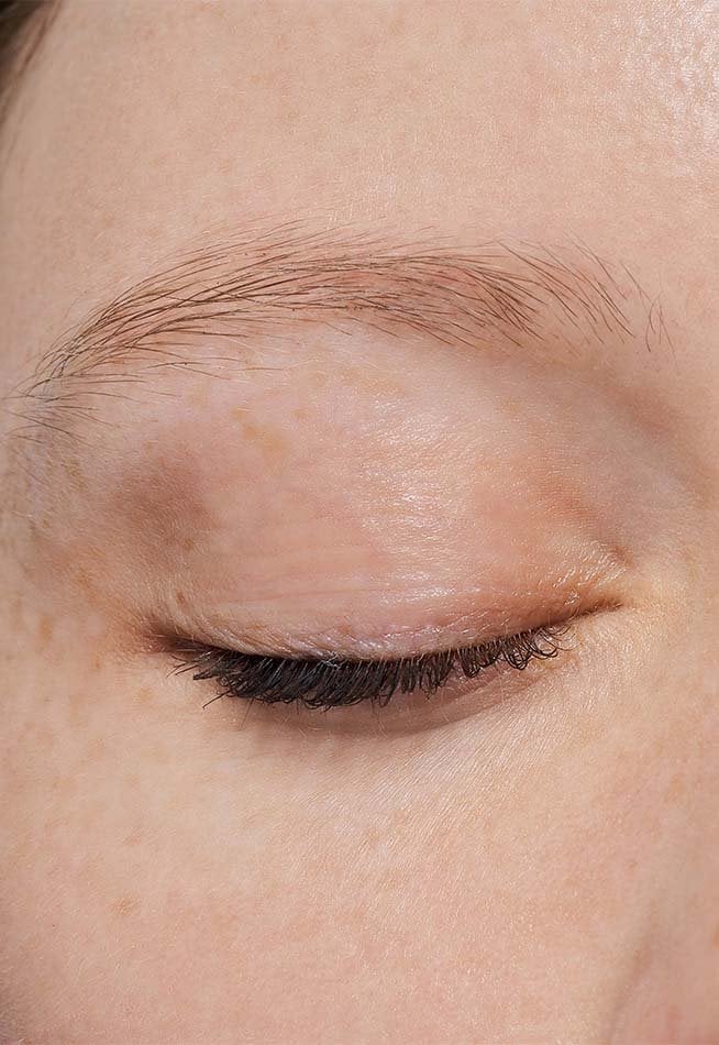 DARK BLONDE Before Mobile