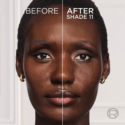 SL 07 2694939 OAP ANZ Tinted Balm Before After 11 ATF03 3000x3000