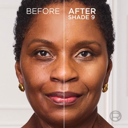 SL 07 2694939 OAP ANZ Tinted Balm Before After 9 ATF03 3000x3000
