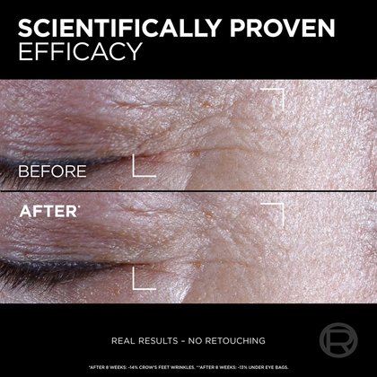20230205digitalageperfectcellrenewalmidnighteyecreamvisibleresultsATF05nadmiimagenanoctav1