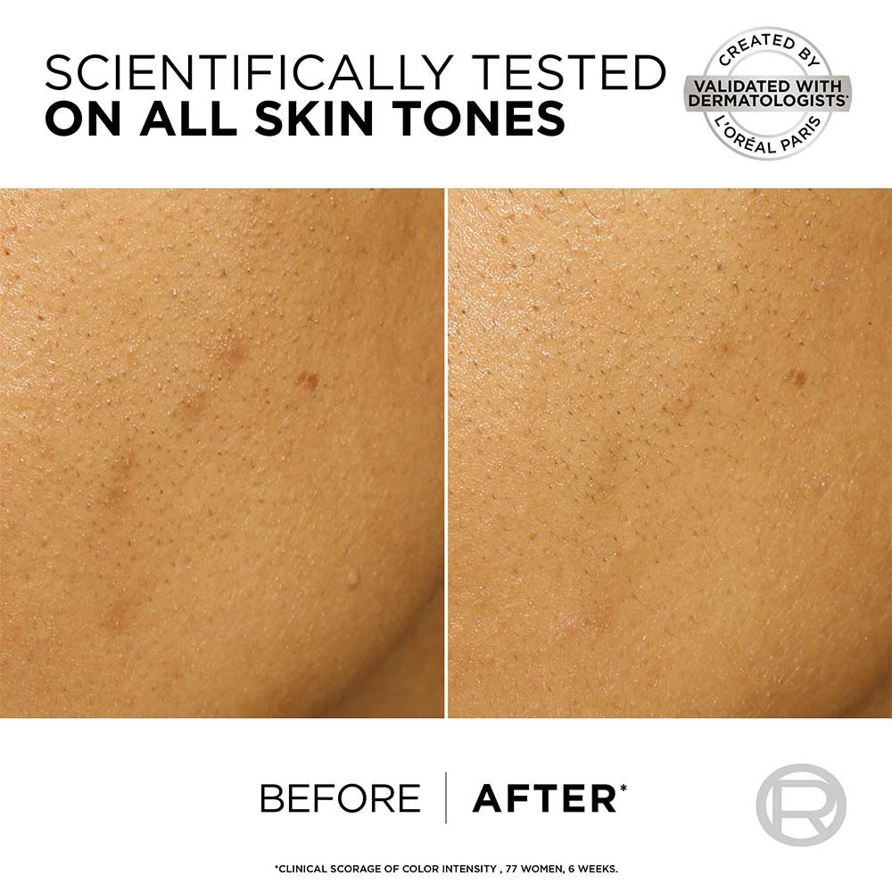 AHA + BHA Peel for Dark Spots | L'Oréal Paris Australia & NZ