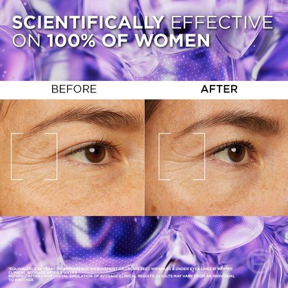 before and after filler dark circle serum