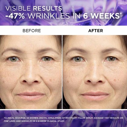 47% reduction in wrinkes in 6 weeks - before and after