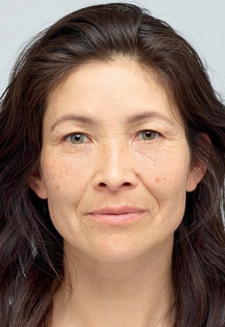 Before applying Revitalift Filler hyaluronic acid face serum