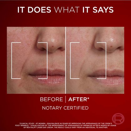 4 Laser X3 Day Cream