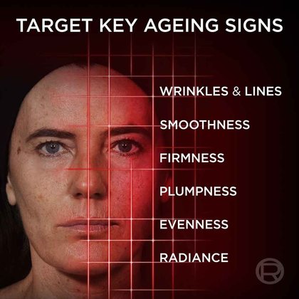 revitalift laser anti ageing serum results